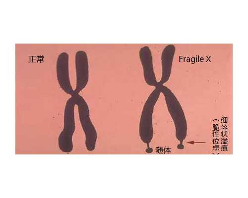 代孕医院哪里找,临夏有做助孕试管婴儿的医院吗？