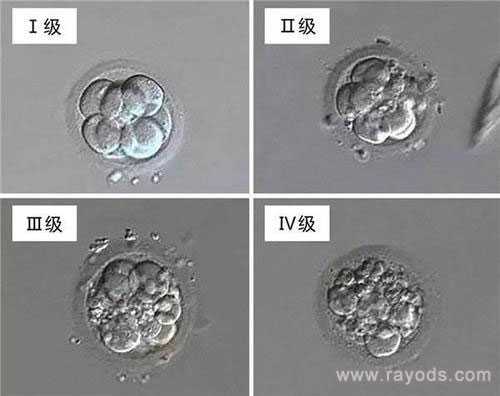 包成功率的助孕公司_试管助孕公司_试管胚胎等级分类，二级胚胎是不是优质胚